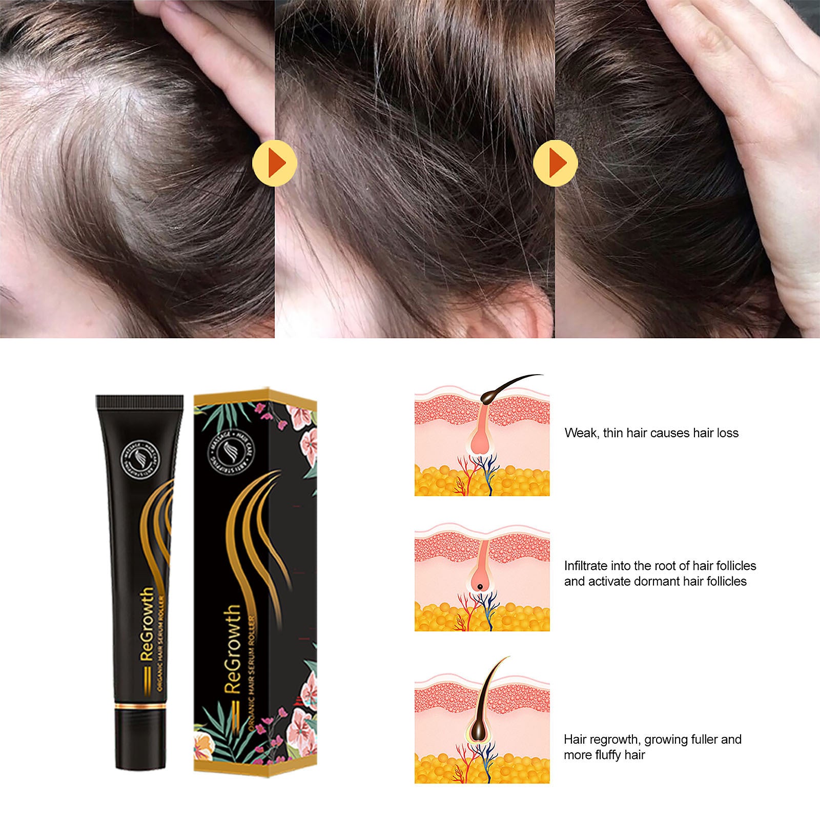 Regrowth Organic Hair Serum Roller Set Hair Care Anti Stripping Liquid Suitable For All Types Of Hair Loss Scalp Nourishing Regrowth Organic Hair Serum Roller Set Hair Care Anti Stripping Liquid Suitable For All Types Of Hair Loss Scalp Nourishing